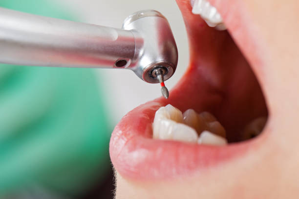 Best Urgent Dental Care for Toothache in South Congaree, SC